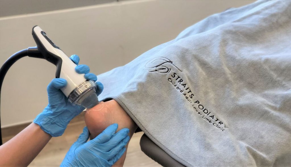 Achilles Tendonitis Treatment in Singapore. A photo showing the podiatrist at Straits Podiatry performing shockwave therapy for the treatment of achilles tendonitis.