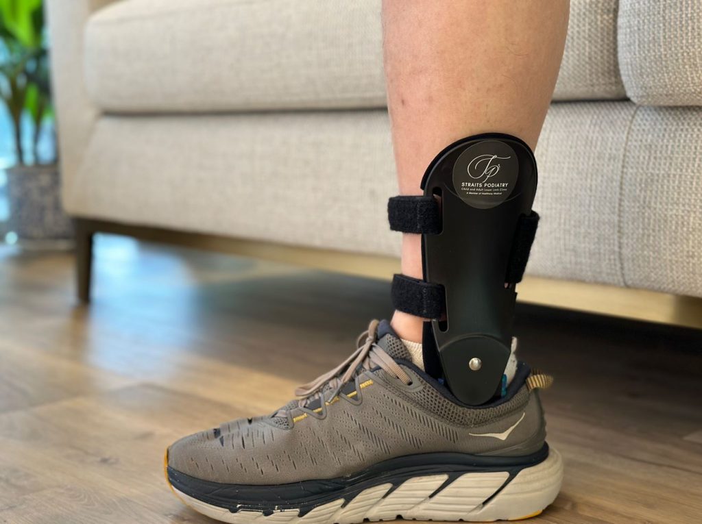 Posterior tibial tendon dysfunction treatment Singapore. How to treat posterior tibial tendinitis? Straits Podiatry