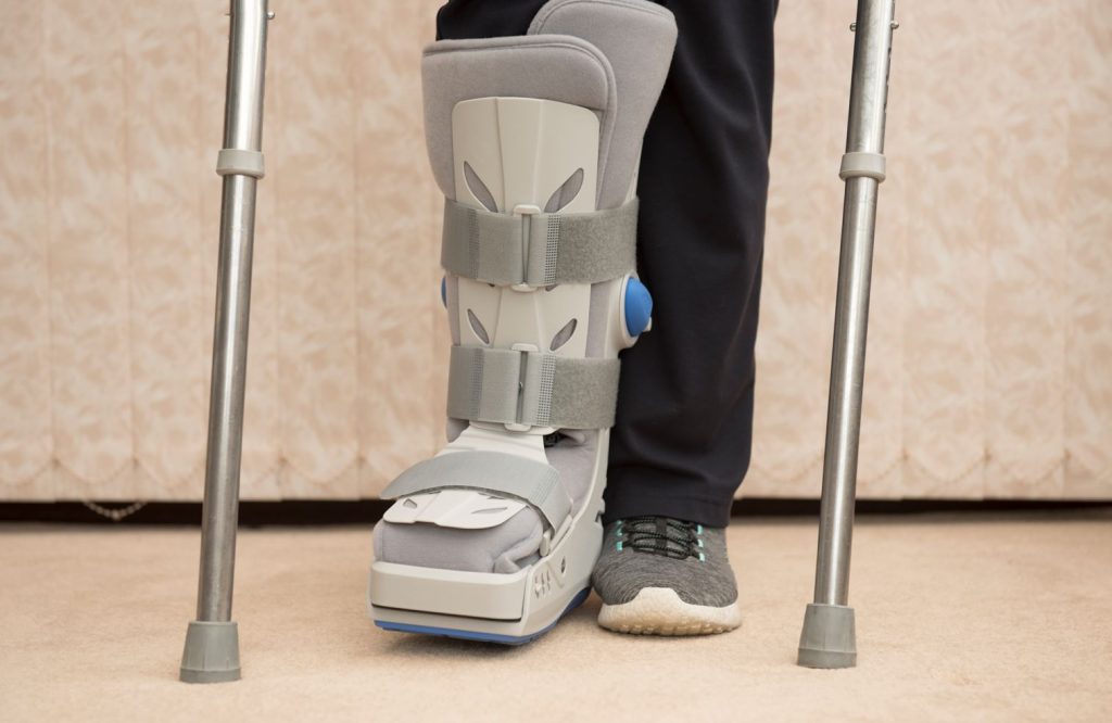 Charcot Foot Treatment in Singapore.