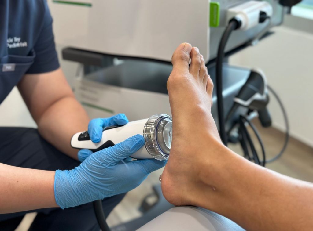 What is Shockwave therapy? Extracorporeal Shockwave Therapy (ESWT) at Straits Podiatry