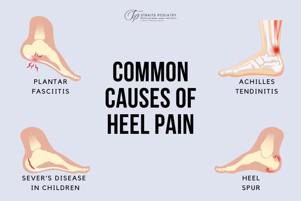 Causes of Heel Pain. An infographic created by Straits Podiatry in Singapore to show the common causes of heel pain.